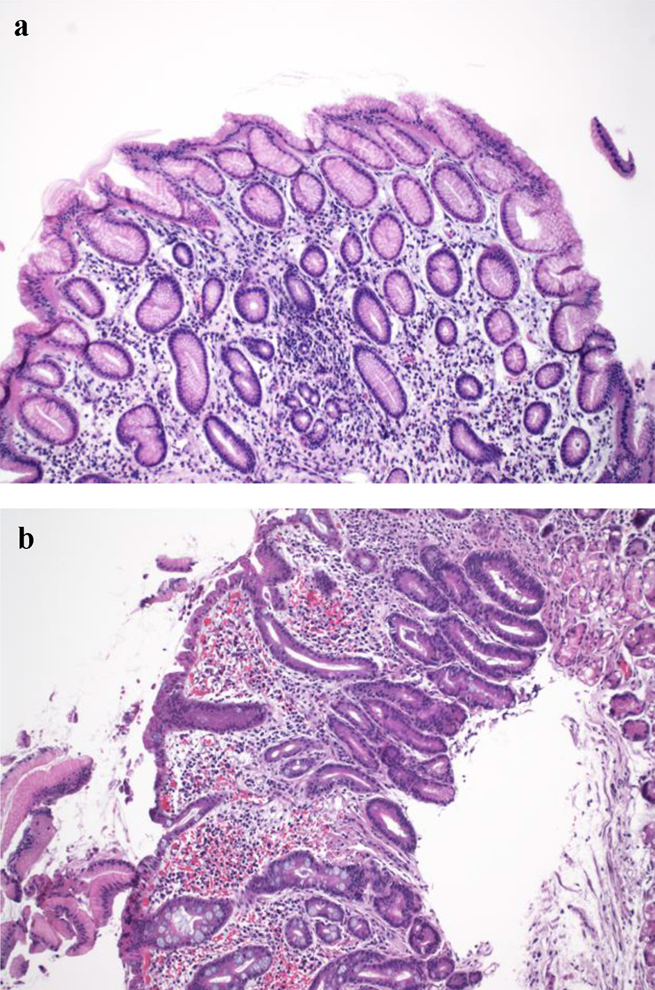 Gastroenterol Res